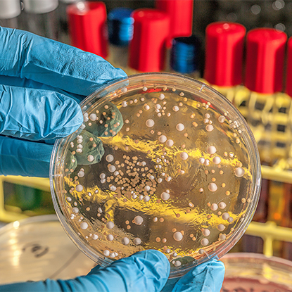 Kesihatan dan Kawalan Penyakit